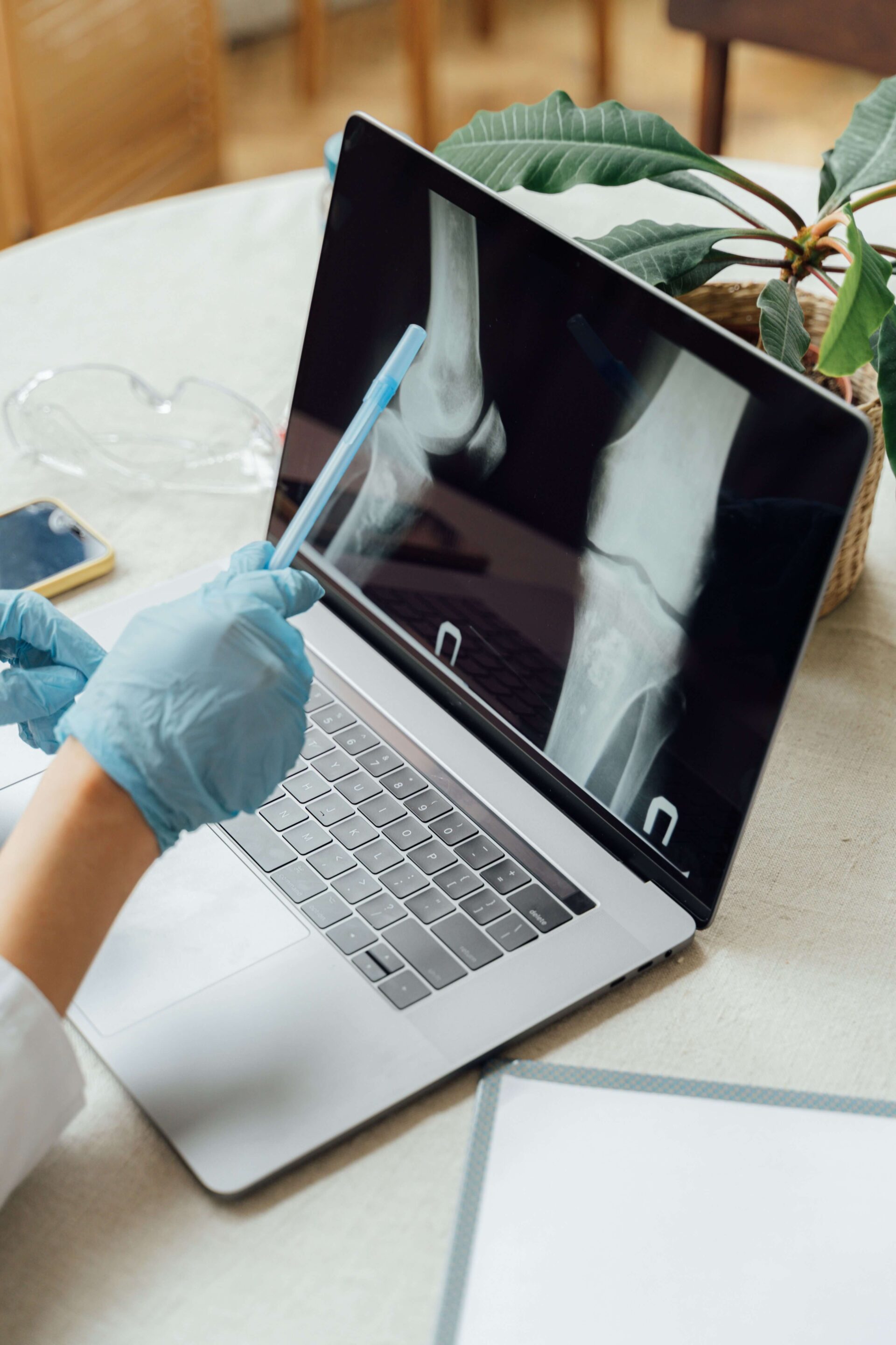 Knee replacement surgery for Knee
Osteoarthritis