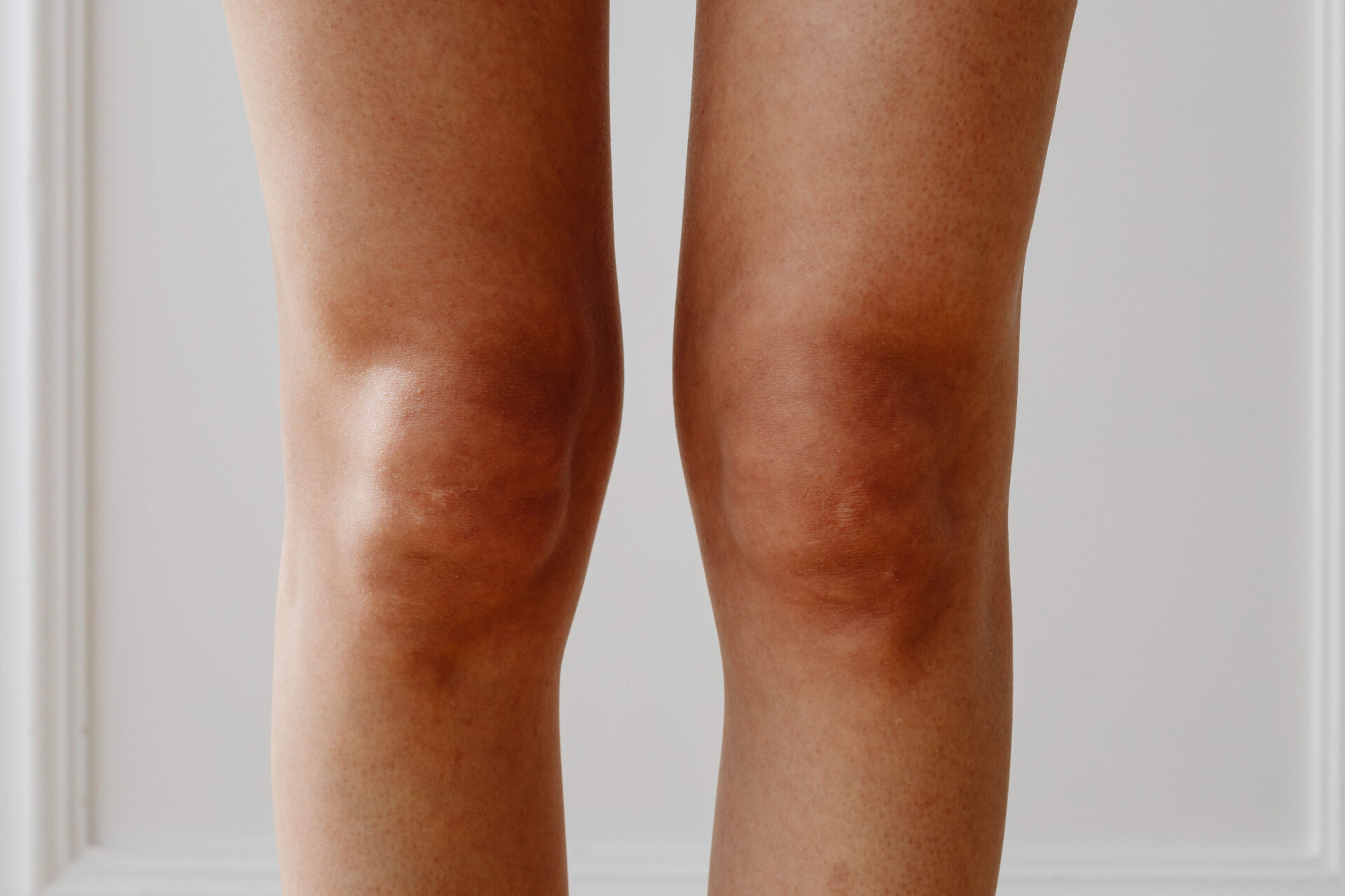 TREATMENT NEVER STOPPED FOR COVID